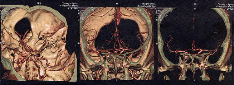 Tomogram głowy u dorosłego człowieka. Fot. Piotr Frydecki 